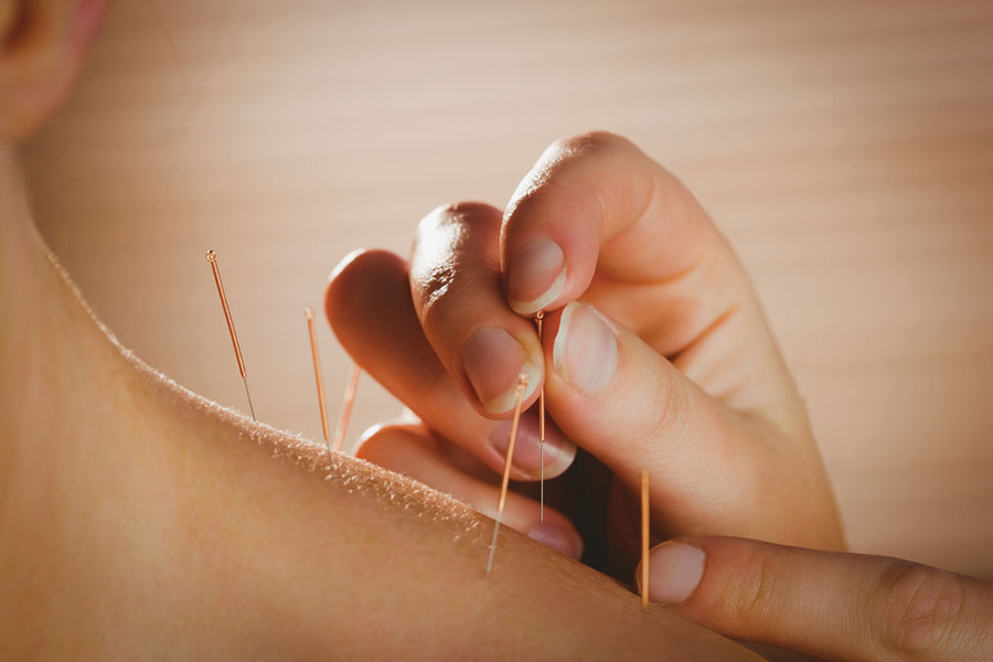 Vital Health Therapy - Acupuncture, South Florida