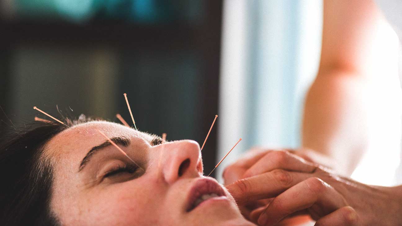 Facial Acupuncture West Palm Beach
